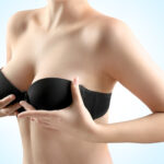 Male to female breast surgery